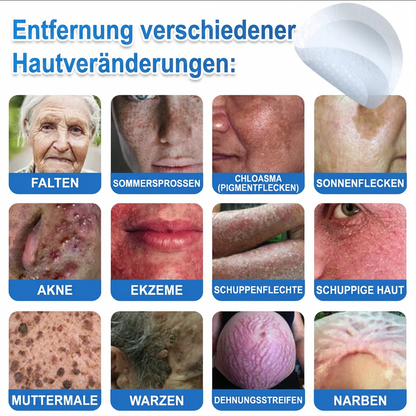 👩‍⚕️TopSpire® 2-in-1 Mikronadel- & Hydrokolloid-Pflaster | Entferner für erhabene Muttermale, Akne, flache Warzen & Hautanhängsel | Verbessert Falten, Narben & Hautunreinheiten | Unsichtbare Stern-Pickelpflaster für Gesicht & Körper