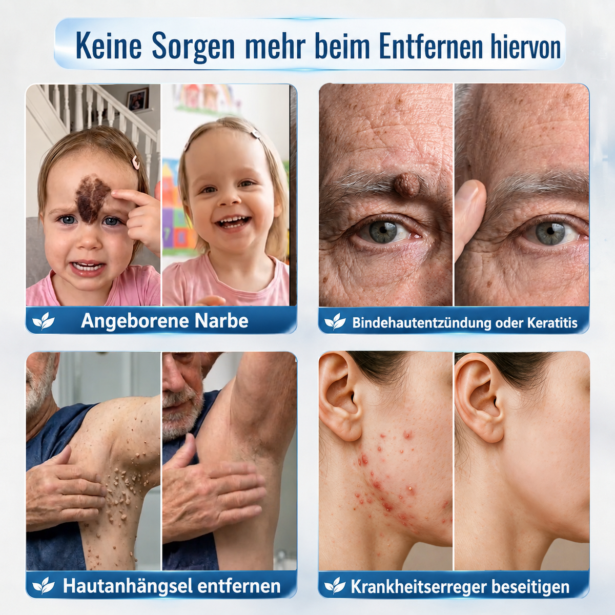 Natravor® 𝟕-𝐓𝐚𝐠𝐞 𝐇𝐚𝐮𝐭𝐚𝐧𝐡ä𝐧𝐠𝐬𝐞𝐥- & 𝐅𝐥𝐞𝐜𝐤𝐞𝐧-𝐄𝐧𝐭𝐟𝐞𝐫𝐧𝐮𝐧𝐠𝐬𝐜𝐫𝐞𝐦𝐞 (𝐒𝐜𝐡𝐦𝐞𝐫𝐳𝐟𝐫𝐞𝐢𝐞 𝐅𝐨𝐫𝐦𝐞𝐥 – 𝐨𝐡𝐧𝐞 𝐍𝐚𝐫𝐛𝐞𝐧) 🎉