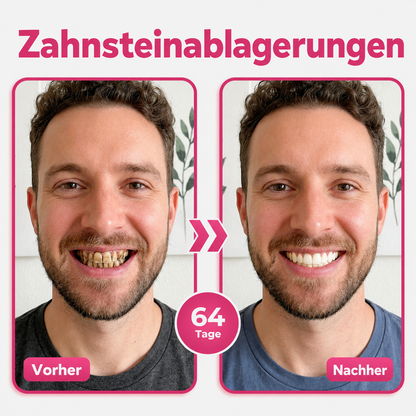 🎁Enjoy 30% OFF for adding the second one